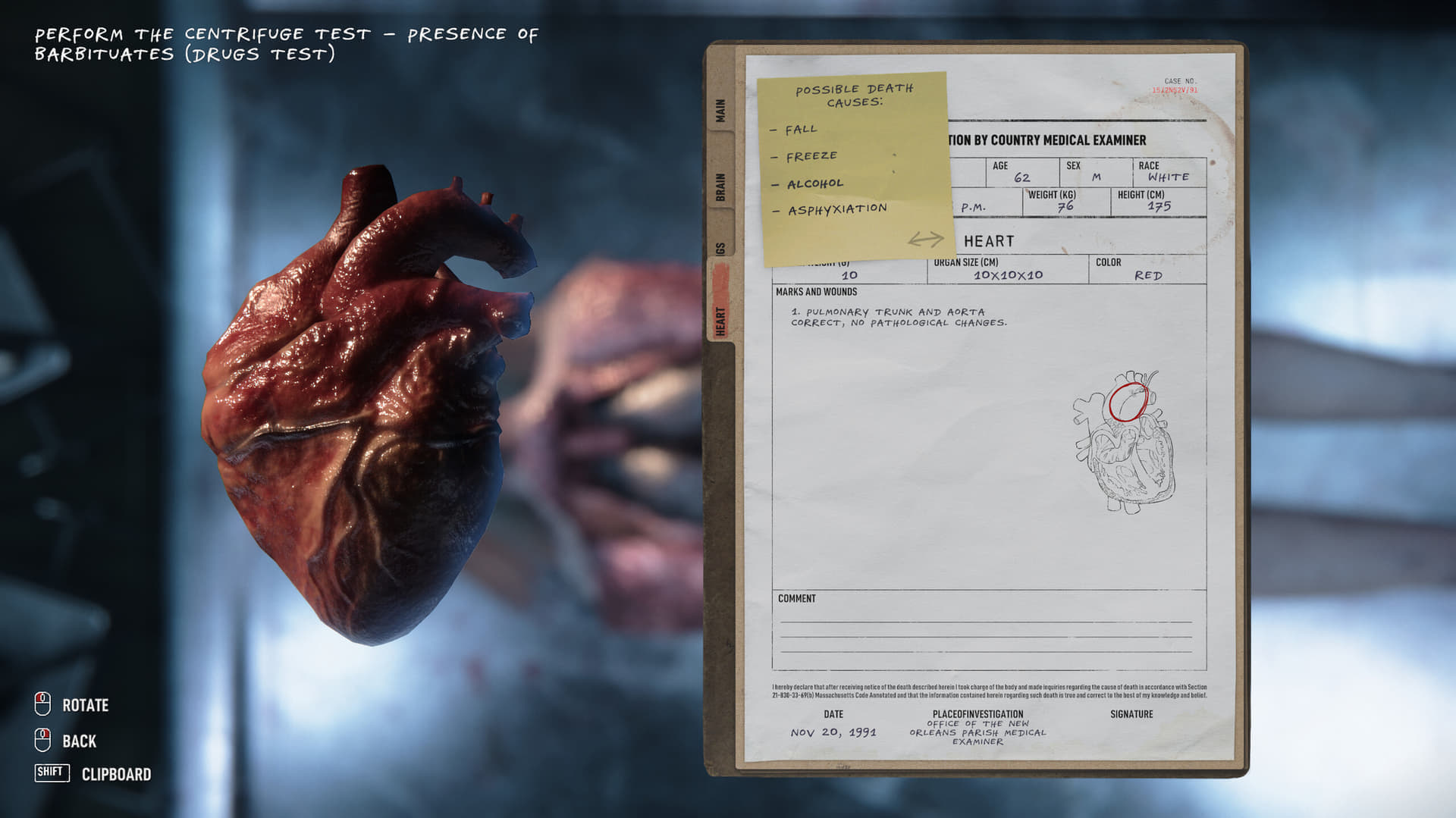 超リアルな検視をして死因を究明するホラー検視シュミレーションゲーム『Autopsy Simulator』が6月7日午前1時に発売_003